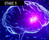 Stage 1 Restoring the Mind-Body Connection