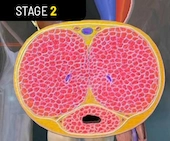 Stage 2 Enhancing Blood Flow